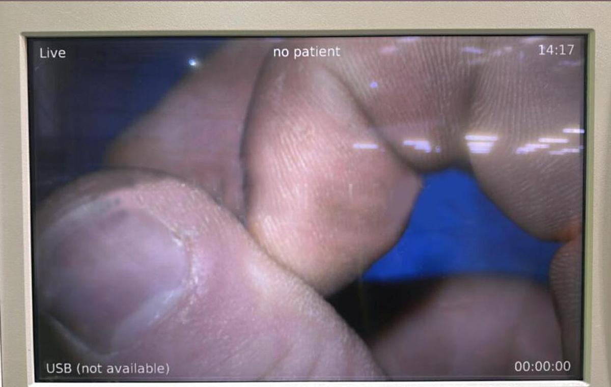 D'occasion KARL ZEISS LUMERA 700 OPERATING OPHTHALMOLOGY MICROSCOPE