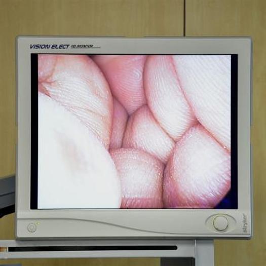 Used STRYKER RIGID ENDOSCOPY COLUMN