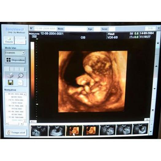 Used ACCUVIX XQ 3D/4D ULTRASOUND SCANNER WITH 4 PROBES