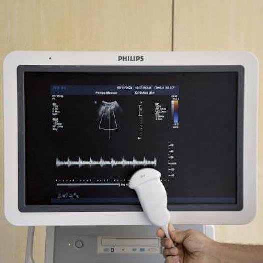 Used PHILIPS IU22 RADIO + CARDIO + GYNECO ECHOCARDIOGRAPH