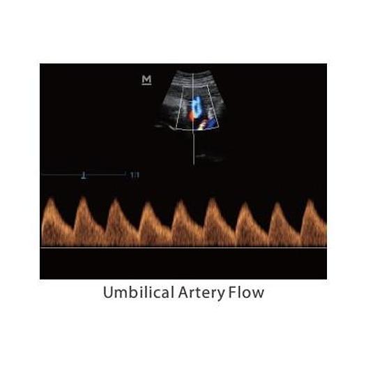 MINDRAY Z5 COLOR DOPPLER SYSTEM
