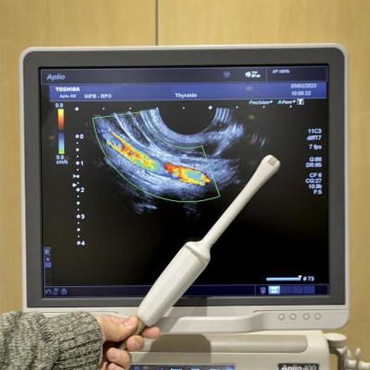 Used TOSHIBA APLIO 400 ULTRASOUND SCANNER WITH 3 PROBES