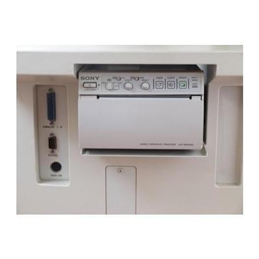 SHIMADZU SDU450XL ULTRASOUND SCANNER