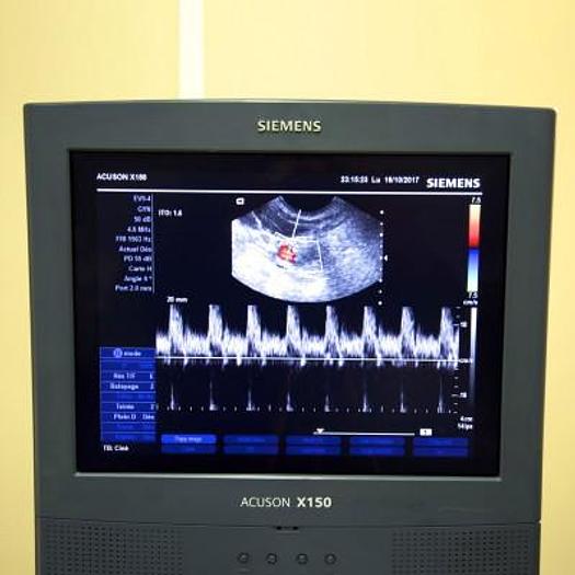 Used SIEMENS ACUSON X150 COLOR DOPPLER ULTRASOUND SCANNER