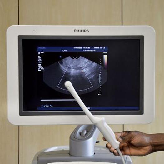 Used PHILIPS IU22 3D/4D RADIO ECHOCARDIOGRAPH + CARDIO + GYNECO