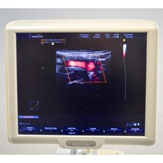 Used ECHO-DOPPLER SAMSUNG MEDISON SONOACE X8