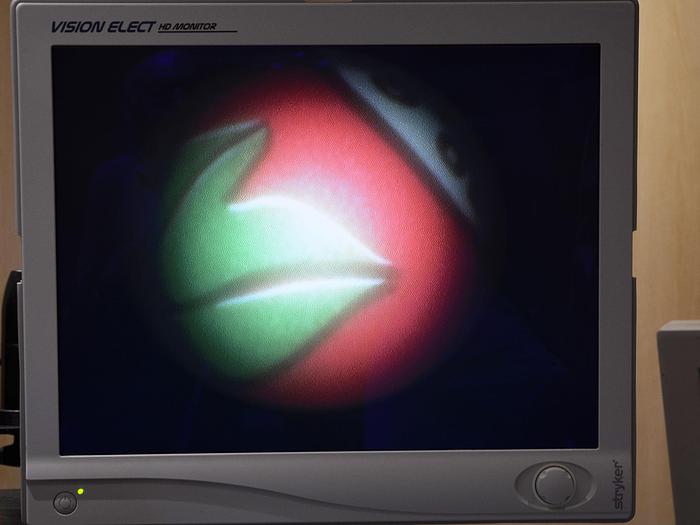 Used OLYMPUS URETEROSCOPE