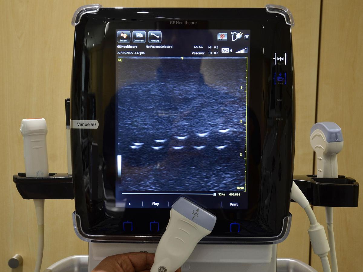 D'occasion GENERAL ELECTRIC GE VENUE 40 PORTABLE ULTRASOUND ON ITS MOBILE STAND