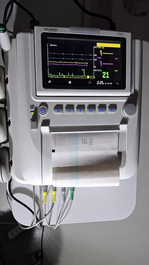 Rénové TOCOCARDIOGRAPHE CTG  PHILIPS GOLDWAY (gemellaire) FHR FETAL MONITOR TWINS