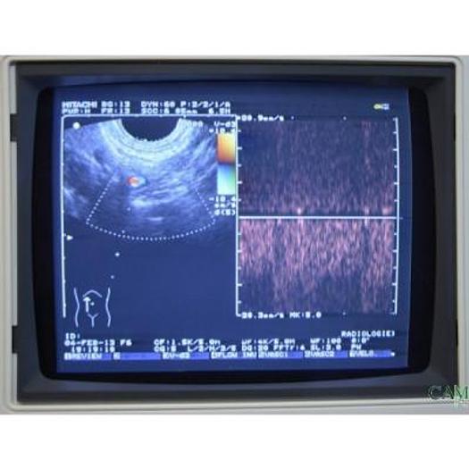 Used HITACHI EUB 525 COLOR DOPPLER ULTRASOUND WITH 2 PROBES