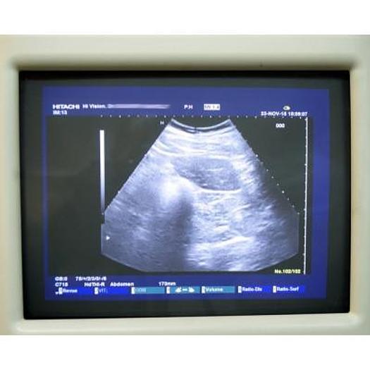 Used HITACHI HI VISION PREMIUM PLATFORM ULTRASOUND WITH 3 PROBES