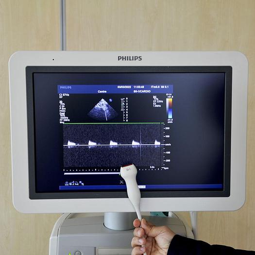 Used PHILIPS IU22 ECHOCARDIOGRAPH (CARDIO+VASCULAR)