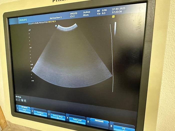 Used PHILIPS HD9 3D/4D ULTRASOUND with 4 PROBES