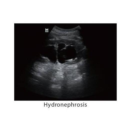 MINDRAY Z5 COLOR DOPPLER SYSTEM