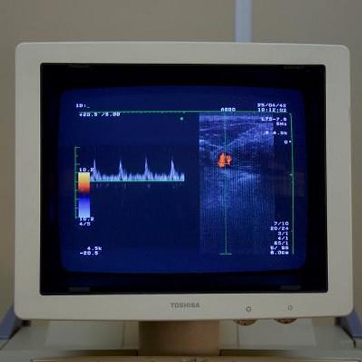 Used TOSHIBA POWERVISION COLOR DOPPLER ULTRASOUND SCANNER