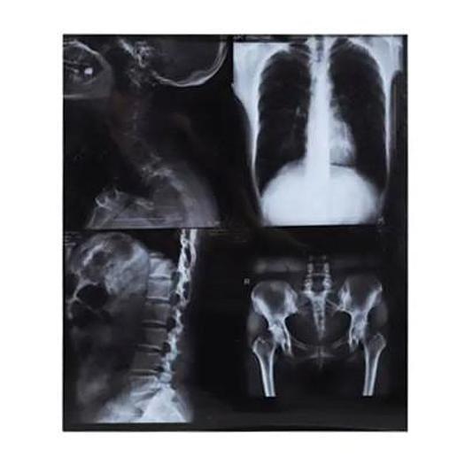 MEDICAL LASER REPROGRAPH FILM 10 x 12 in. (25 x 30 cm) BOX OF 100 sheets