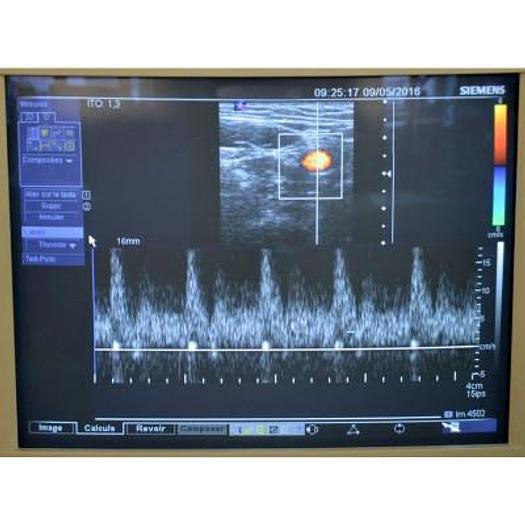 Used SIEMENS VFX9-4 LINEAR FREQUENCY PROBE FROM 4 TO 9 MHZ FOR SIEMENS ANTARES