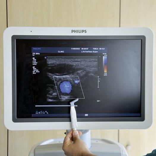 Used PHILIPS IU22 VASCULAR ULTRASOUND SCANNER