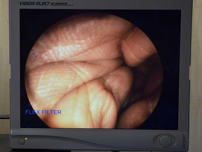 Used KARL STORZ NEPHROSCOPE SET Ø 26