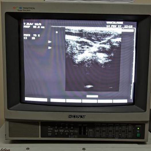 Used ESAOTE MEDICA AU4 IDEA COLOR DOPPLER ULTRASOUND SCANNER WITH 2 PROBES