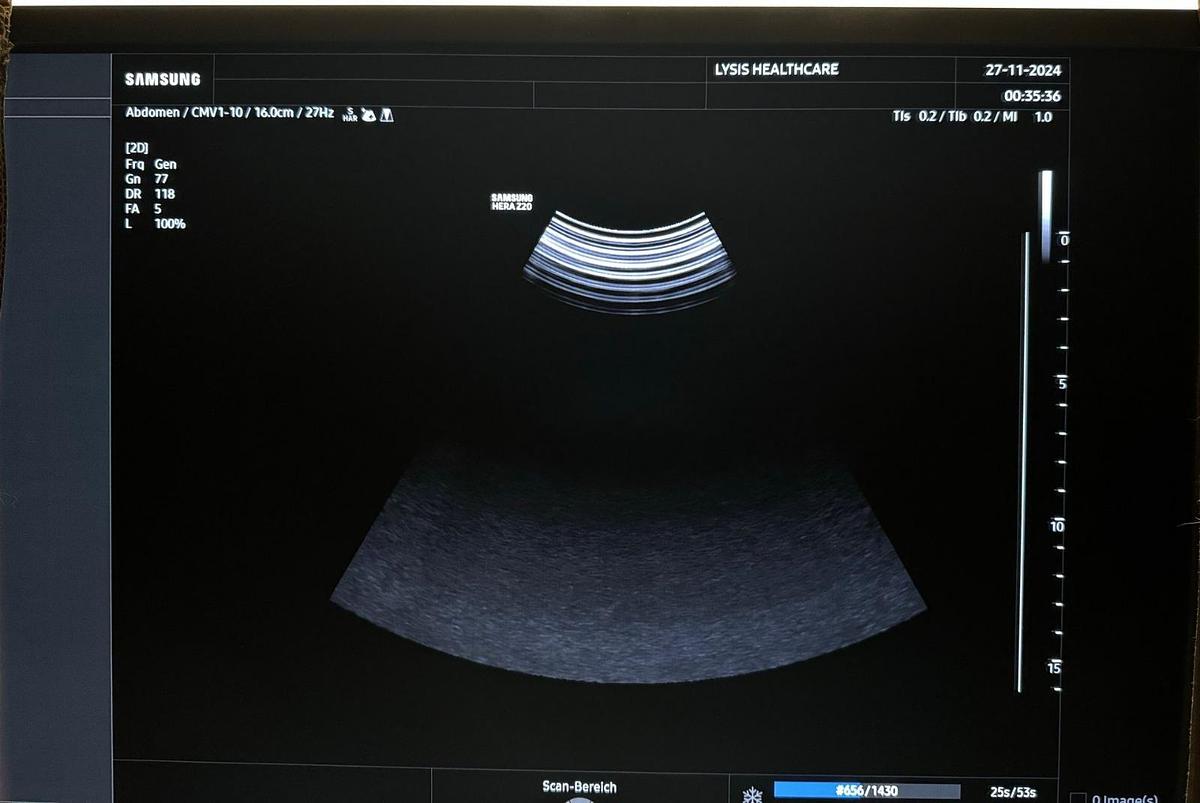 Rénové SAMSUNG Z20 ULTRASOUND