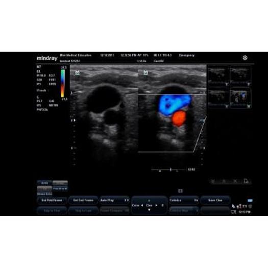 Used MINDRAY M7 PORTABLE ULTRASOUND SCANNER ( 2013 )
