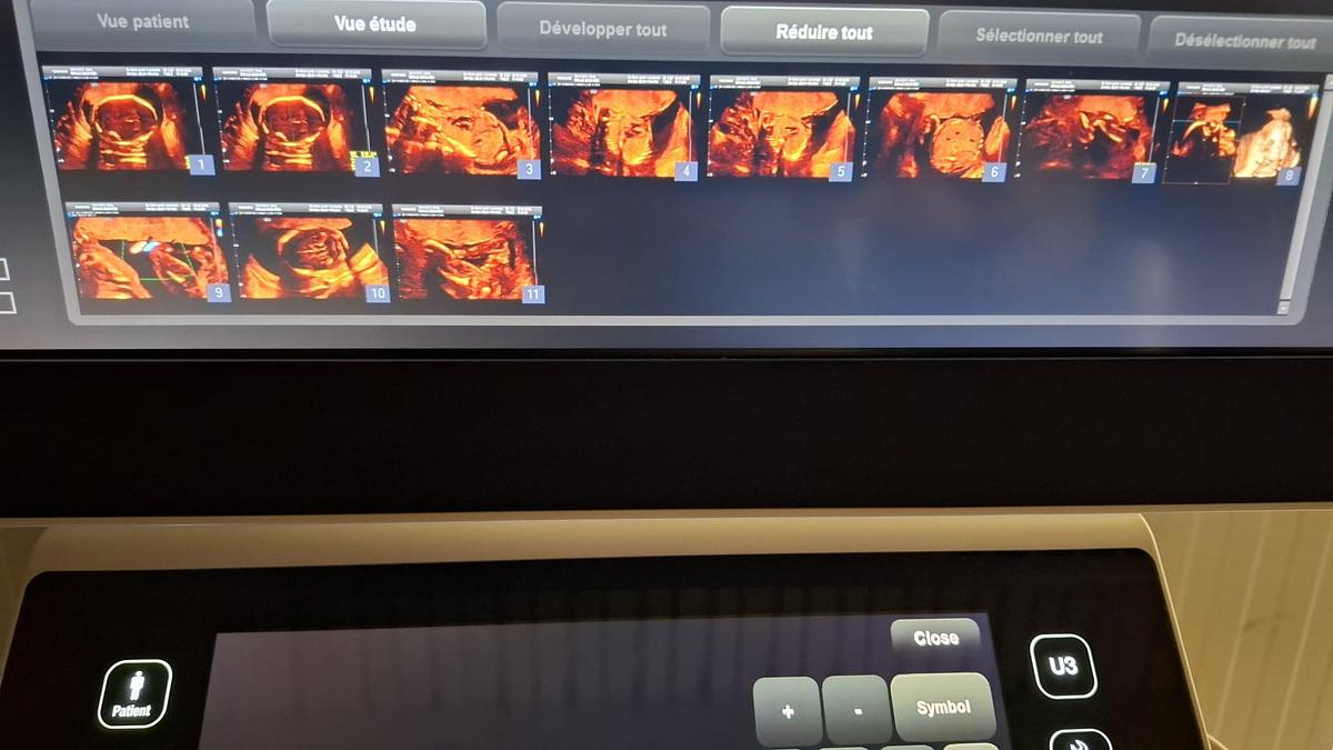 D'occasion ECHOGRAPHE SAMSUNG WS80A ELITE