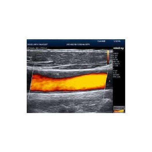 Used MINDRAY M7 PORTABLE ULTRASOUND SCANNER ( 2013 )