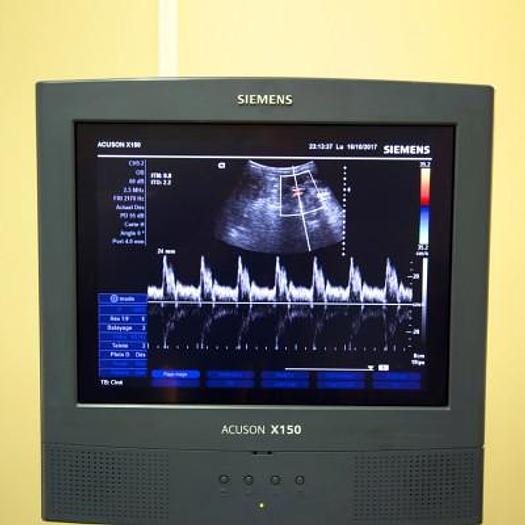 Used SIEMENS ACUSON X150 COLOR DOPPLER ULTRASOUND SCANNER