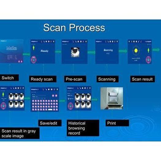 Used PROSTATE ULTRASOUND (URO) MEIKE PBS