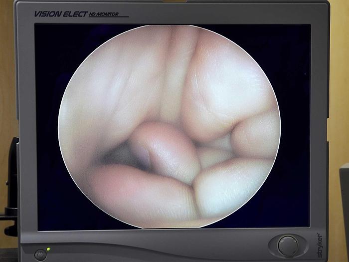 Used STRYKER ARTHROSCOPY SET