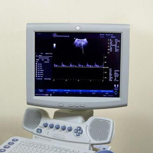 Used LOGIQ A5 GENERAL ELECTRIC ULTRASOUND SCANNER WITH FLAT SCREEN