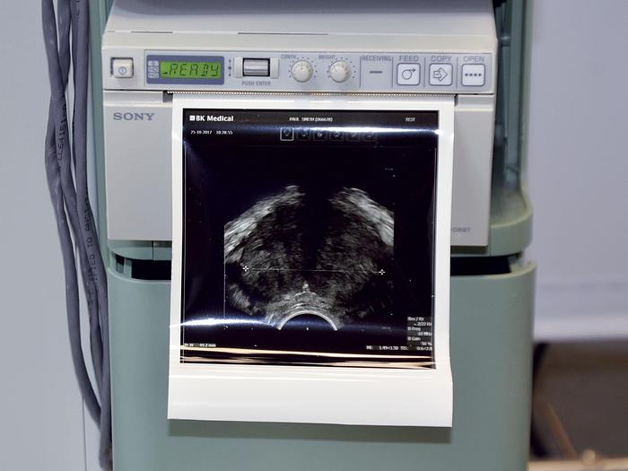 Used ECHOGRAPH BK FOCUS 700 (model 1202)