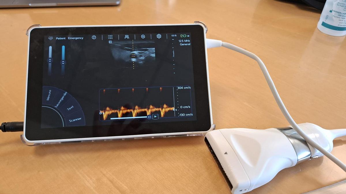 original-d-occasion-echographe-super-portable-sonoscanner-u-lite-pro.jpeg