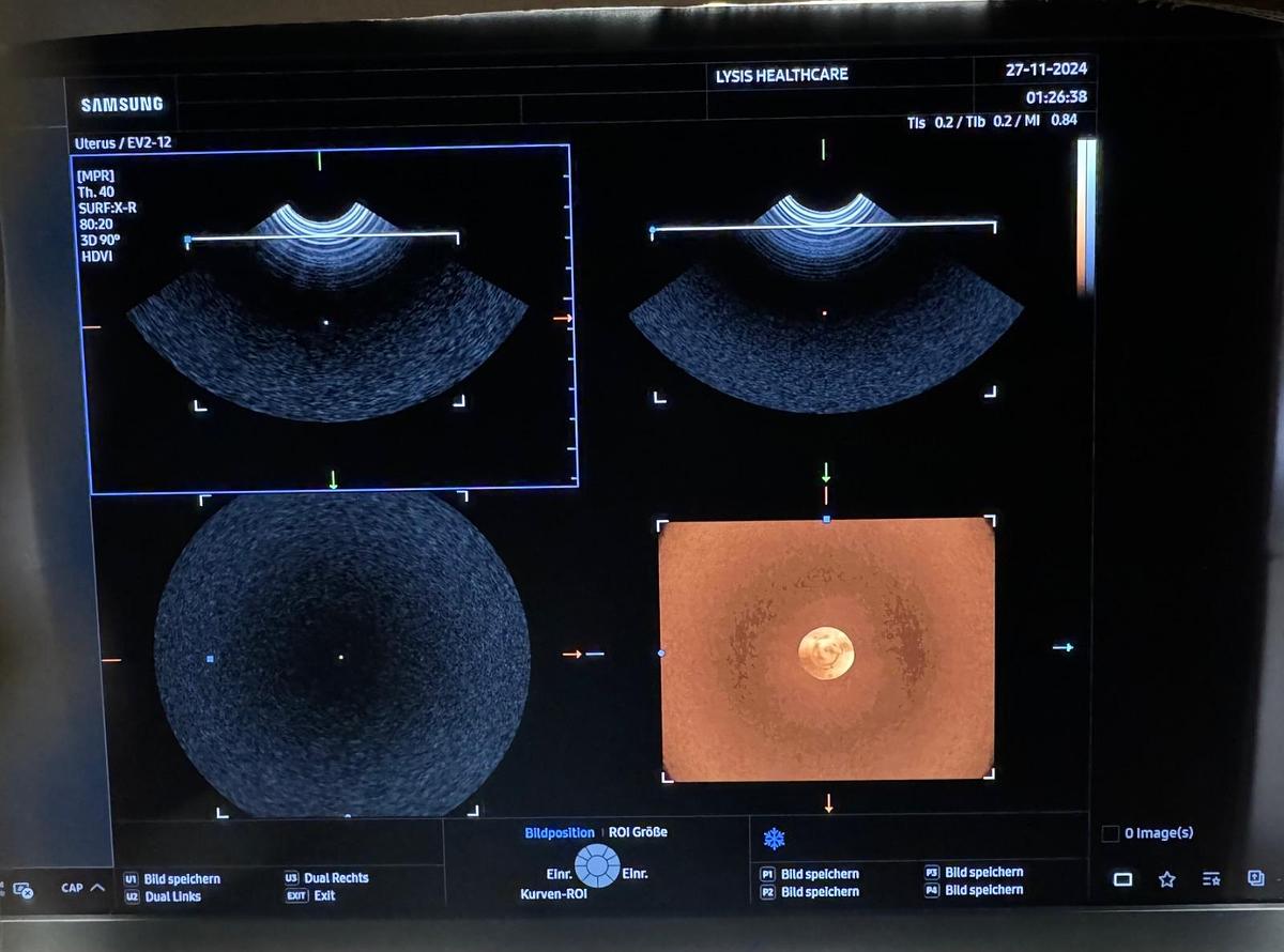 Rénové SAMSUNG Z20 ULTRASOUND