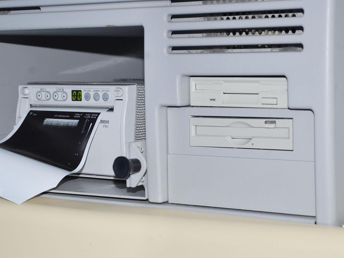 original-d-occasion-echographe-philips-hdi-5000.JPG