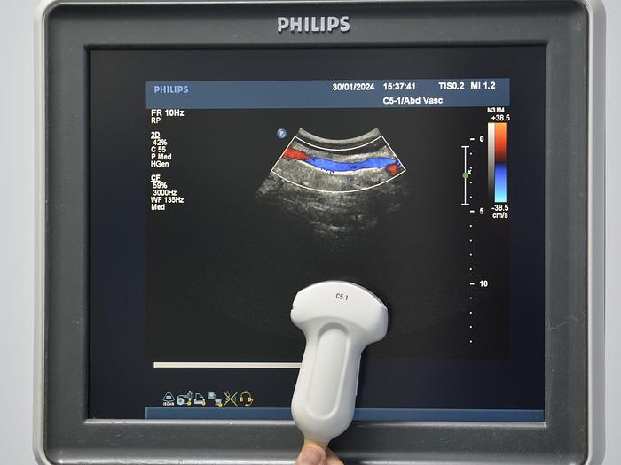 D'occasion ECHOGRAPHE PHILIPS IU22