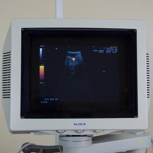 Used ALOKA PROSOUND 5500 COLOR DOPPLER ULTRASOUND WITH ABDOMINAL PROBE AND ENDOVAGINAL PROBE