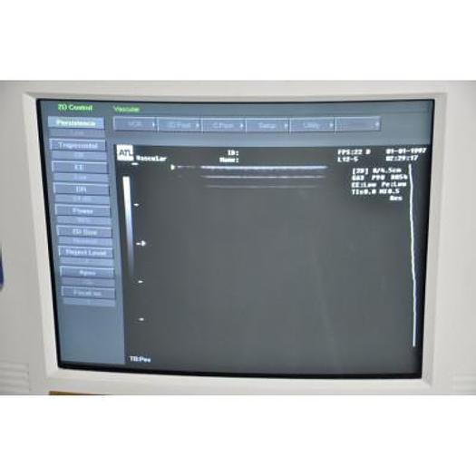 Used PHILIPS HDI 1500 COLOR DOPPLER ULTRASOUND