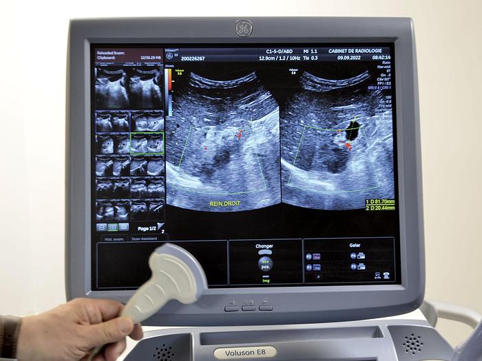 Used VOLUSON E8 GENERAL ELECTRIC ULTRASOUND