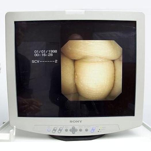 Used OLYMPUS CV-240 DIGESTIVE ENDOSCOPY COLUMN WITH OLYMPUS CYF 240 VIDEO CYSTOSCOPE