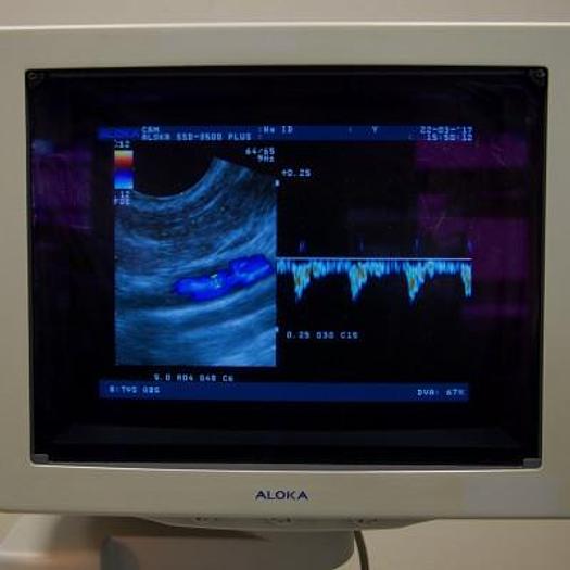 Used ALOKA PROSOUND 3500 PLUS COLOR DOPPLER ULTRASOUND WITH 2 PROBES