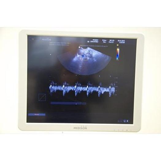 Used MEDISON ACCUVIX V20 ULTRASOUND SCANNER WITH CONVEX 3D/4D VOLUMETRIC ABDOMINAL PROBE