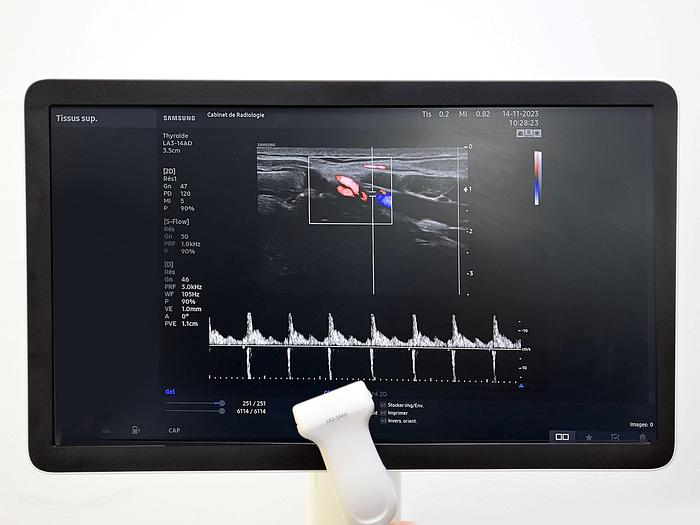 Used SAMSUNG HS 50 ULTRASOUND SCANNER