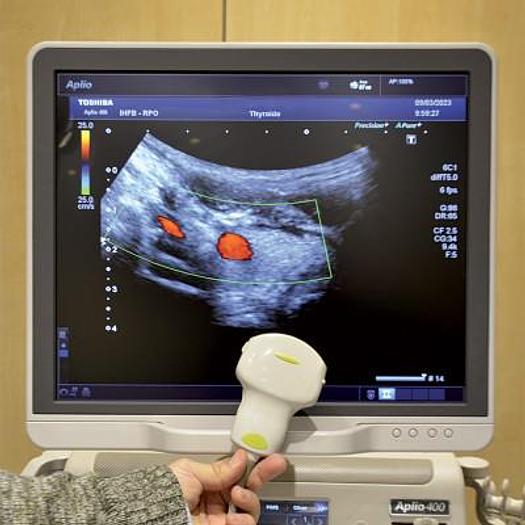 Used TOSHIBA APLIO 400 ULTRASOUND SCANNER WITH 3 PROBES