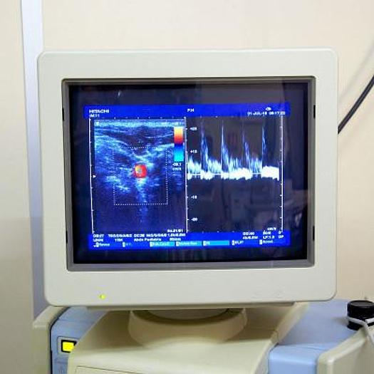 Used HITACHI EUB-6500 PEDIATRIC ECHOCARDIOGRAPH