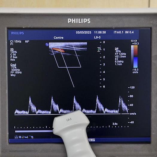 Used ECHOCARDIOGRAPHE PHILIPS IE33 RADIO CARDIO GYNECO