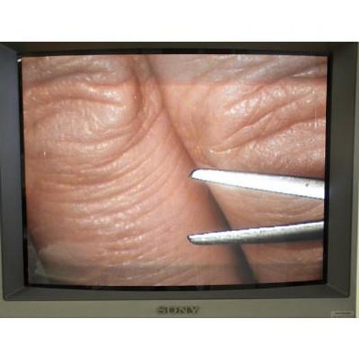 Used STORZ URBAN OPHTHALMIC OPERATING MICROSCOPE, FOOT CONTROLS FOR XY, ZOOM, FOCUS