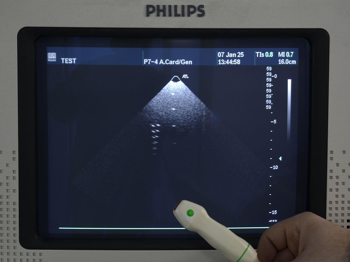 original-d-occasion-echographe-philips-hdi-5000.JPG
