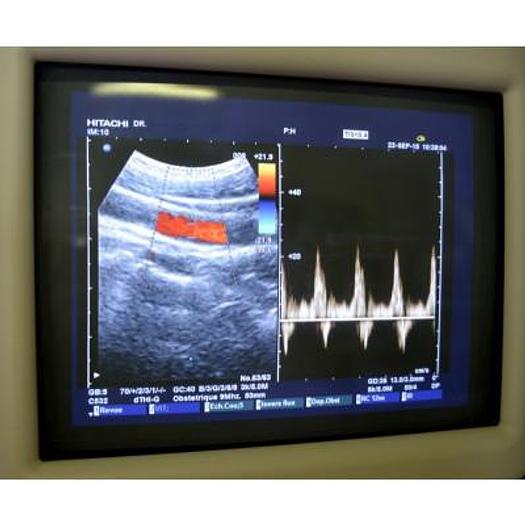 Used HITACHI EUB 6500 PLATFORM ELITE COLOR ULTRASOUND SCANNER WITH 4 PROBES